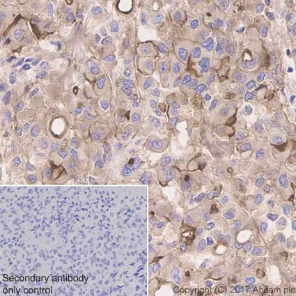 Immunohistochemistry (Formalin/PFA-fixed paraffin-embedded sections) - Anti-Mesothelin antibody [EPR19025-42] (AB196235)