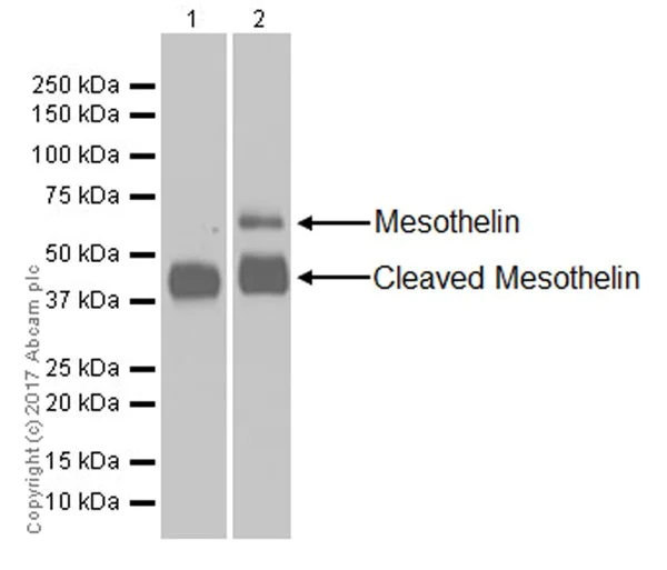 Western blot - Anti-Mesothelin antibody [EPR19025-42] (AB196235)