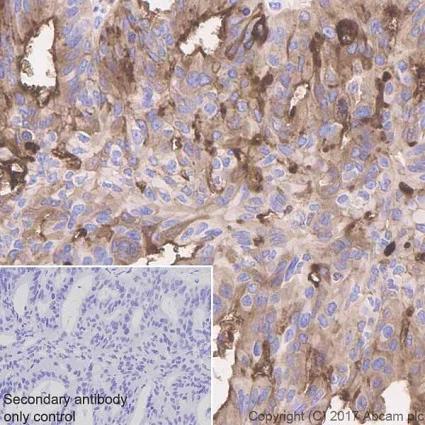 Immunohistochemistry (Formalin/PFA-fixed paraffin-embedded sections) - Anti-Mesothelin antibody [EPR19025-42] - BSA and Azide free (AB227810)