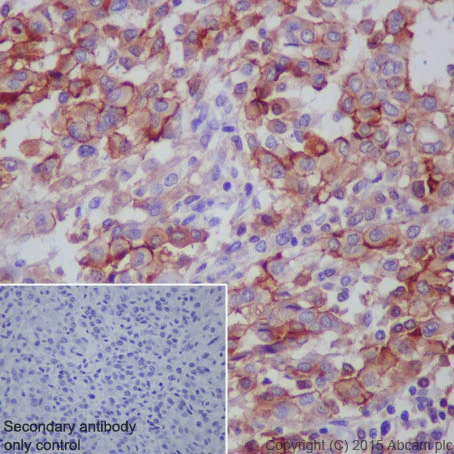 Immunohistochemistry (Formalin/PFA-fixed paraffin-embedded sections) - Anti-Mesothelin antibody [EPR2685(2)] (AB134109)
