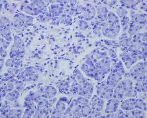 Immunohistochemistry (Formalin/PFA-fixed paraffin-embedded sections) - Anti-Mesothelin antibody [EPR2685(2)] (AB134109)