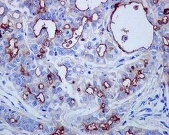 Immunohistochemistry (Formalin/PFA-fixed paraffin-embedded sections) - Anti-Mesothelin antibody [EPR2685(2)] (AB134109)