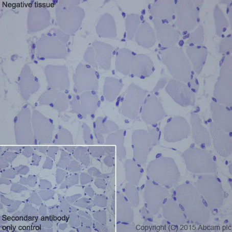 Immunohistochemistry (Formalin/PFA-fixed paraffin-embedded sections) - Anti-Mesothelin antibody [EPR2685(2)] (AB134109)