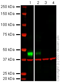 Western blot - Anti-Mesothelin antibody [EPR2685(2)] (AB134109)
