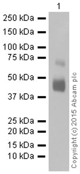Western blot - Anti-Mesothelin antibody [EPR2685(2)] (AB134109)