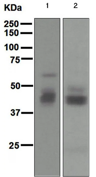 Western blot - Anti-Mesothelin antibody [EPR2685(2)] (AB134109)