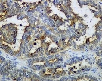 Immunohistochemistry (Formalin/PFA-fixed paraffin-embedded sections) - Anti-Mesothelin antibody [EPR2685(2)] - BSA and Azide free (AB232411)