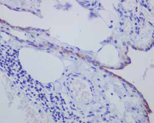 Immunohistochemistry (Formalin/PFA-fixed paraffin-embedded sections) - Anti-Mesothelin antibody [EPR2685(2)] - BSA and Azide free (AB232411)