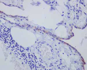 Immunohistochemistry (Formalin/PFA-fixed paraffin-embedded sections) - Anti-Mesothelin antibody [EPR2685(2)] - BSA and Azide free (AB232411)