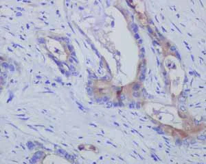 Immunohistochemistry (Formalin/PFA-fixed paraffin-embedded sections) - Anti-Mesothelin antibody [EPR2685(2)] - BSA and Azide free (AB232411)