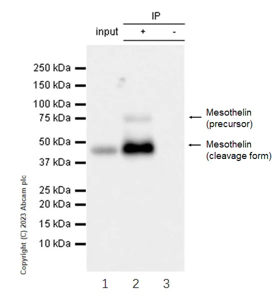 Immunoprecipitation - Anti-Mesothelin antibody [EPR28269-62] (AB309516)