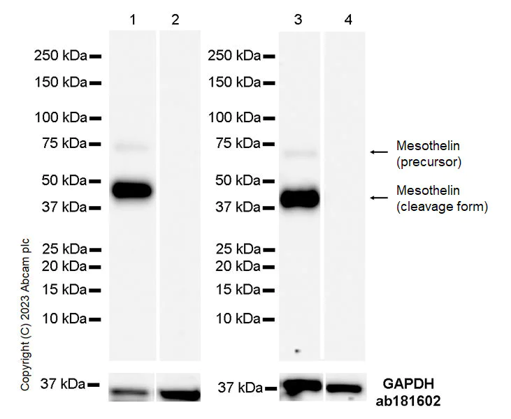 Western blot - Anti-Mesothelin antibody [EPR28269-62] (AB309516)