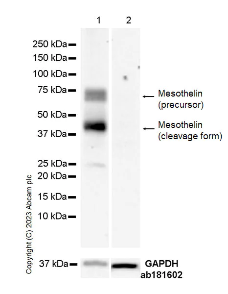 Western blot - Anti-Mesothelin antibody [EPR28269-62] (AB309516)