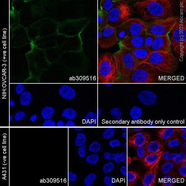 Immunocytochemistry/ Immunofluorescence - Anti-Mesothelin antibody [EPR28269-62] - BSA and Azide free (AB309517)