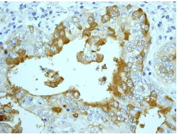 Immunohistochemistry (Formalin/PFA-fixed paraffin-embedded sections) - Anti-Mesothelin antibody [EPR4509] - BSA and Azide free (AB248520)