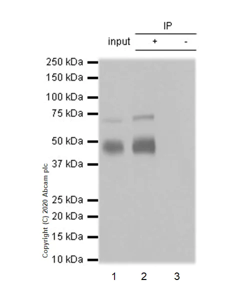 Immunoprecipitation - Anti-Mesothelin antibody [EPR4509] - BSA and Azide free (AB248520)