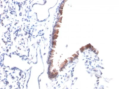 Immunohistochemistry (Formalin/PFA-fixed paraffin-embedded sections) - Anti-Mesothelin antibody [MSLN/2131] (AB236546)