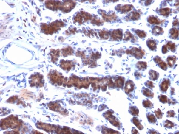Immunohistochemistry (Formalin/PFA-fixed paraffin-embedded sections) - Anti-Mesothelin antibody [MSLN/2131] - BSA and Azide free (AB237817), expandable thumbnail