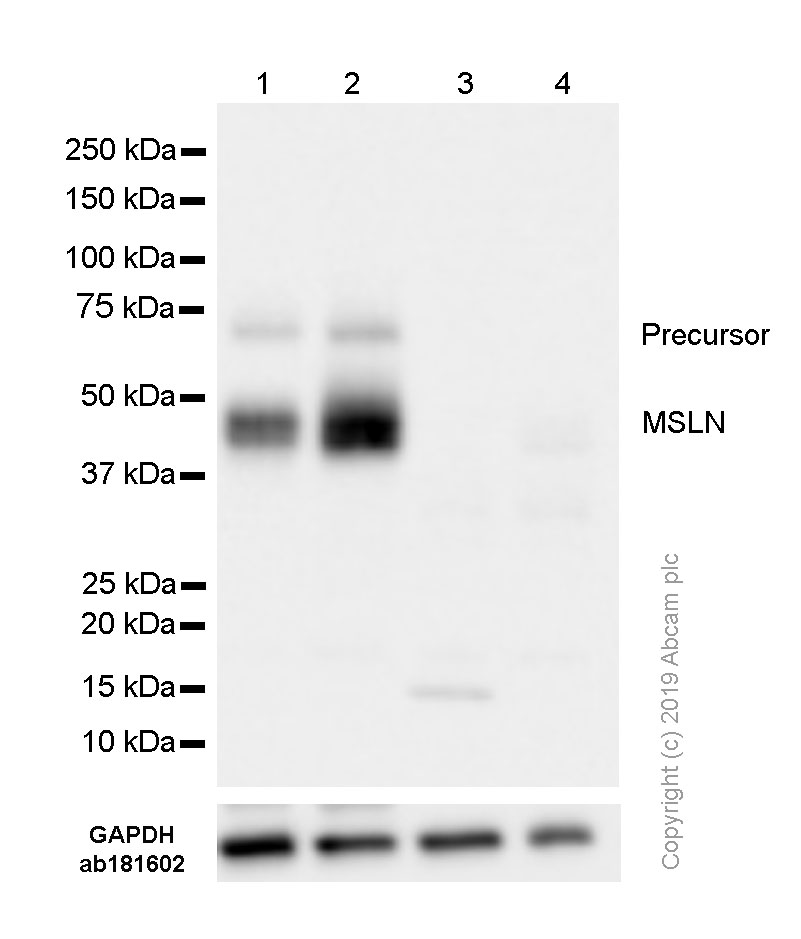 Western blot - Anti-Mesothelin antibody [SP74] (AB93620), expandable thumbnail