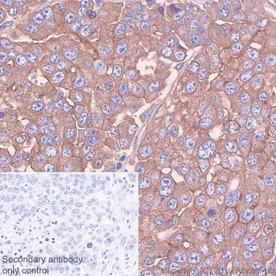 Immunohistochemistry (Formalin/PFA-fixed paraffin-embedded sections) - Anti-Mesothelin antibody [SP74] - BSA and Azide free (AB236217)