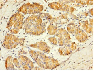 Immunohistochemistry (Formalin/PFA-fixed paraffin-embedded sections) - Anti-Mesp1 antibody (AB230308)