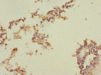 Immunohistochemistry (Formalin/PFA-fixed paraffin-embedded sections) - Anti-MEST antibody (AB230114)