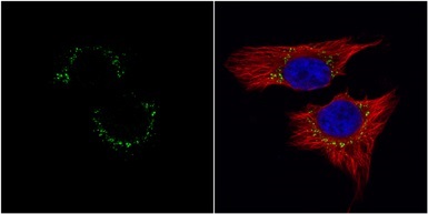 Immunocytochemistry/ Immunofluorescence - Anti-Met (c-Met) antibody (AB137654)