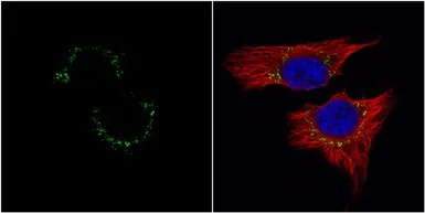 Immunocytochemistry/ Immunofluorescence - Anti-Met (c-Met) antibody (AB137654)