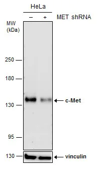 Western blot - Anti-Met (c-Met) antibody (AB137654)