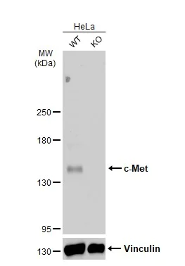 Western blot - Anti-Met (c-Met) antibody (AB137654)