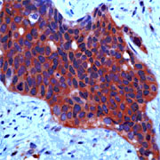 Immunohistochemistry (Formalin/PFA-fixed paraffin-embedded sections) - Anti-Met (c-Met) antibody (AB74217)