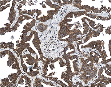 Immunohistochemistry (Formalin/PFA-fixed paraffin-embedded sections) - Anti-Met (c-Met) antibody [CAL12] (AB237711)