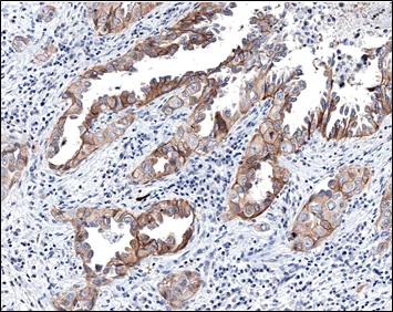 Immunohistochemistry (Formalin/PFA-fixed paraffin-embedded sections) - Anti-Met (c-Met) antibody [CAL12] (AB237711)