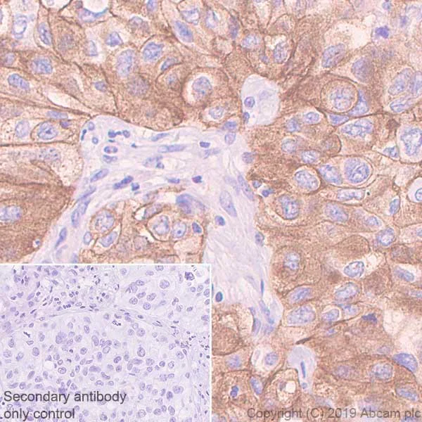 Immunohistochemistry (Formalin/PFA-fixed paraffin-embedded sections) - Anti-Met (c-Met) antibody [CAL12] (AB237711)