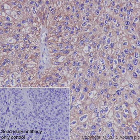 Immunohistochemistry (Formalin/PFA-fixed paraffin-embedded sections) - Anti-Met (c-Met) antibody [EP1454Y] - BSA and Azide free (AB157370)