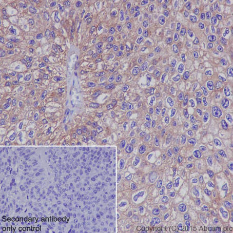 Immunohistochemistry (Formalin/PFA-fixed paraffin-embedded sections) - Anti-Met (c-Met) antibody [EP1454Y] - BSA and Azide free (AB157370)