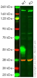 Western blot - Anti-Met (c-Met) antibody [EP1454Y] - BSA and Azide free (AB157370)