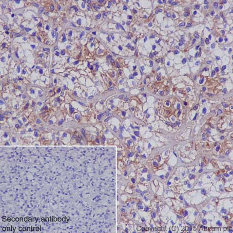 Immunohistochemistry (Formalin/PFA-fixed paraffin-embedded sections) - Anti-Met (c-Met) antibody [EP1454Y] - N-terminal (AB51067)
