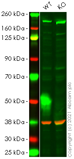 Western blot - Anti-Met (c-Met) antibody [EP1454Y] - N-terminal (AB51067)