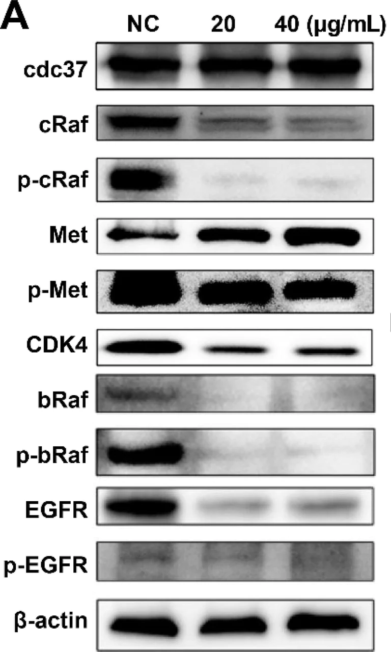 Western blot - Anti-Met (c-Met) antibody [EP1454Y] - N-terminal (AB51067)