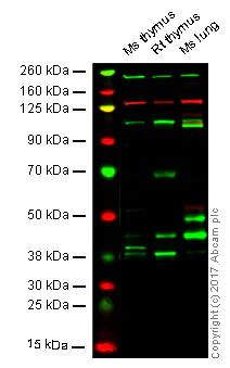 Western blot - Anti-Met (c-Met) antibody [EP1454Y] - N-terminal (AB51067)
