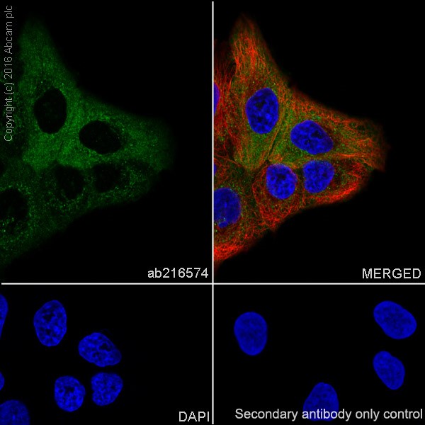 Immunocytochemistry/ Immunofluorescence - Anti-Met (c-Met) antibody [EPR19067] (ab216574), expandable thumbnail