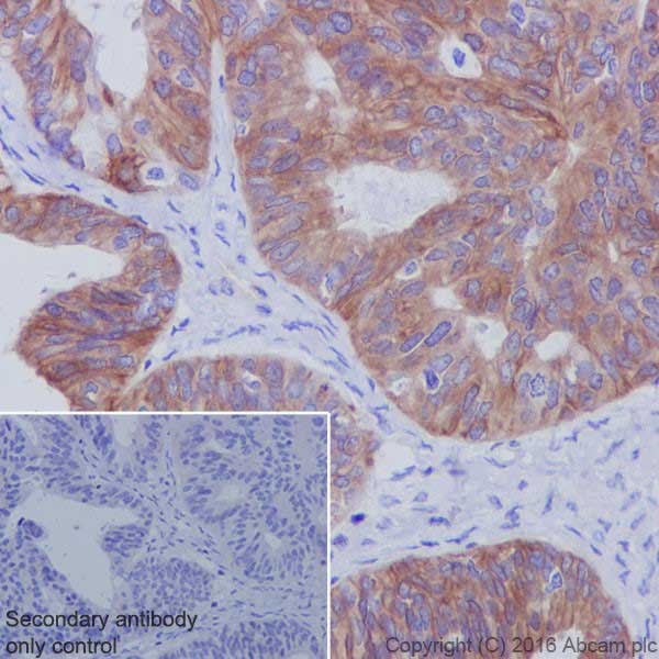 Immunohistochemistry (Formalin/PFA-fixed paraffin-embedded sections) - Anti-Met (c-Met) antibody [EPR19067] (ab216574), expandable thumbnail