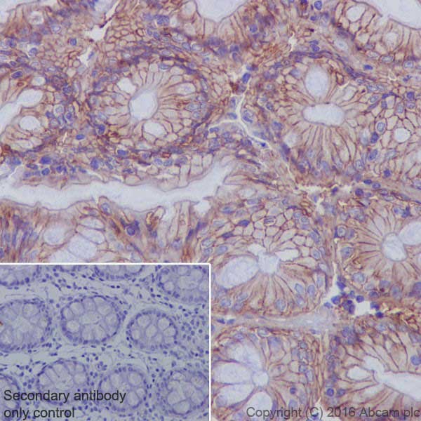 Immunohistochemistry (Formalin/PFA-fixed paraffin-embedded sections) - Anti-Met (c-Met) antibody [EPR19067] (ab216574), expandable thumbnail
