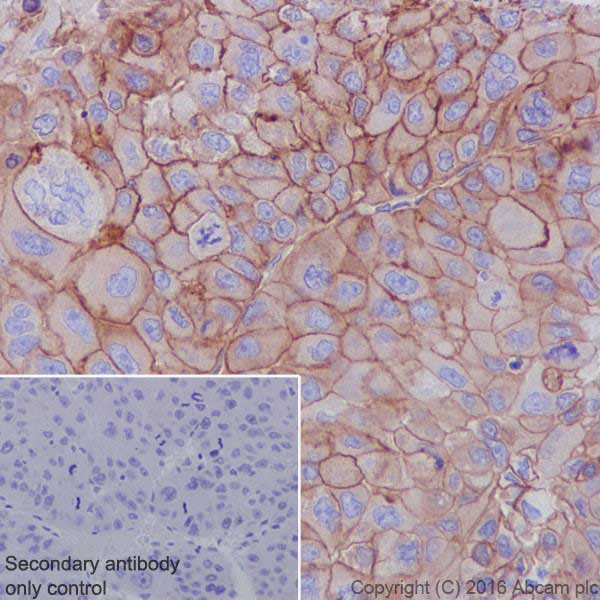Immunohistochemistry (Formalin/PFA-fixed paraffin-embedded sections) - Anti-Met (c-Met) antibody [EPR19067] (ab216574), expandable thumbnail