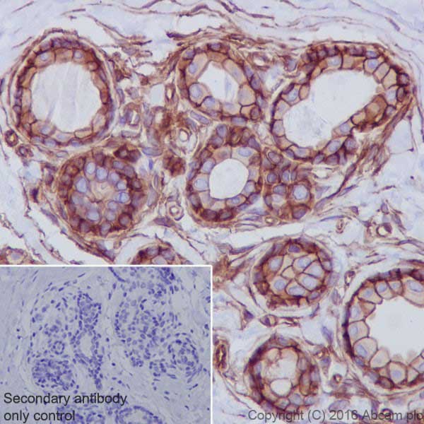 Immunohistochemistry (Formalin/PFA-fixed paraffin-embedded sections) - Anti-Met (c-Met) antibody [EPR19067] (AB216574), expandable thumbnail