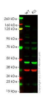 Western blot - Anti-Met (c-Met) antibody [EPR19067] (AB216574), expandable thumbnail