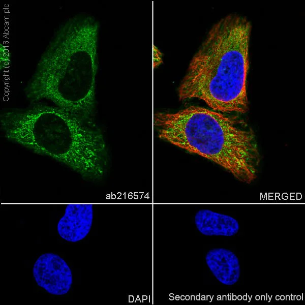 Immunocytochemistry/ Immunofluorescence - Anti-Met (c-Met) antibody [EPR19067] - Low endotoxin, Azide free (AB222925)