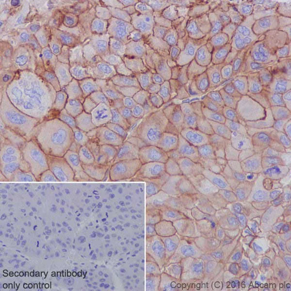 Immunohistochemistry (Formalin/PFA-fixed paraffin-embedded sections) - Anti-Met (c-Met) antibody [EPR19067] - Low endotoxin, Azide free (AB222925)