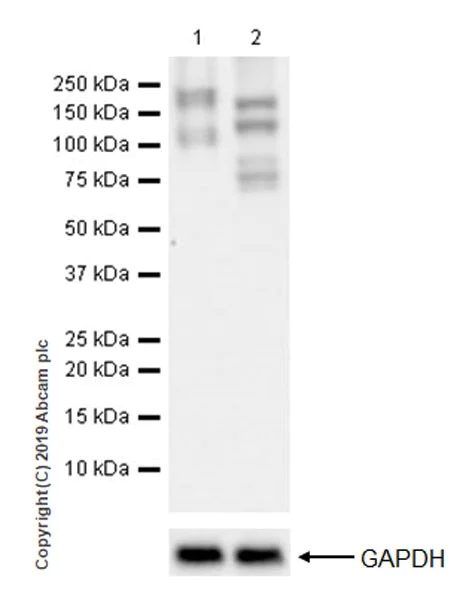 Western blot - Anti-Met (c-Met) antibody [EPR19554-110] (AB254252)